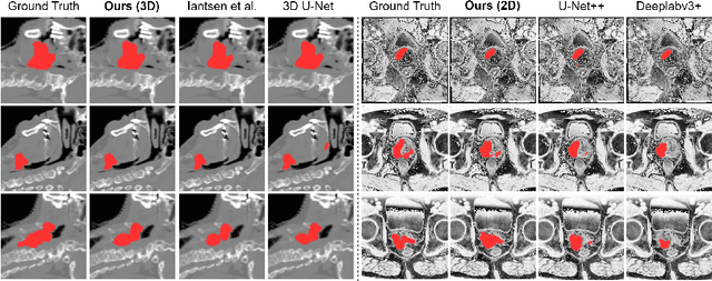 Figure 4 for H-DenseFormer: An Efficient Hybrid Densely Connected Transformer for Multimodal Tumor Segmentation