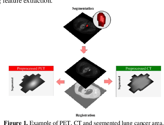 Figure 1 for Enhanced Lung Cancer Survival Prediction using Semi-Supervised Pseudo-Labeling and Learning from Diverse PET/CT Datasets