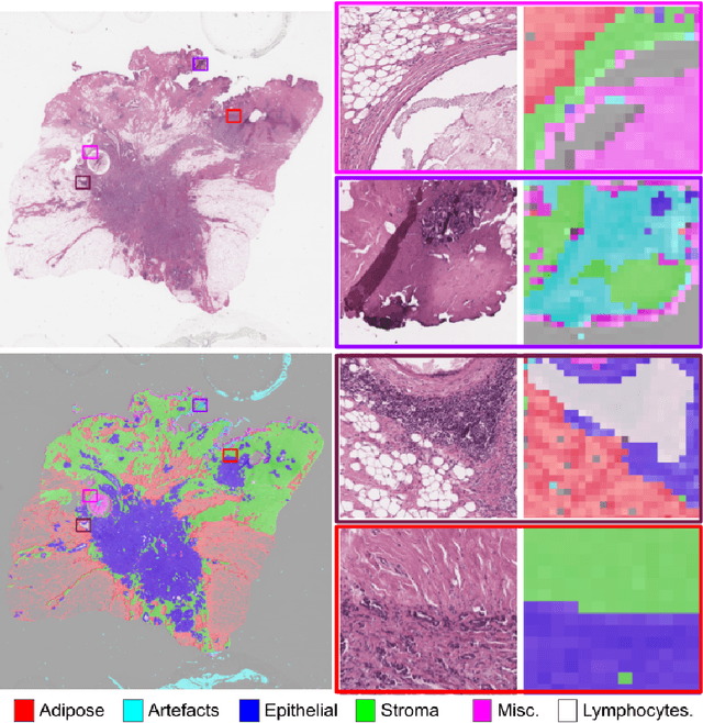 Figure 1 for Efficient Quality Control of Whole Slide Pathology Images with Human-in-the-loop Training