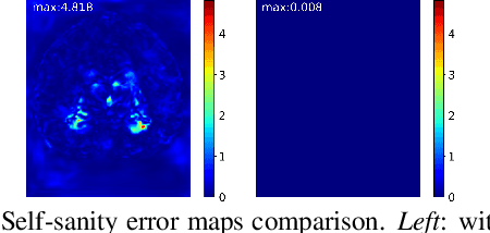 Figure 3 for Towards Saner Deep Image Registration