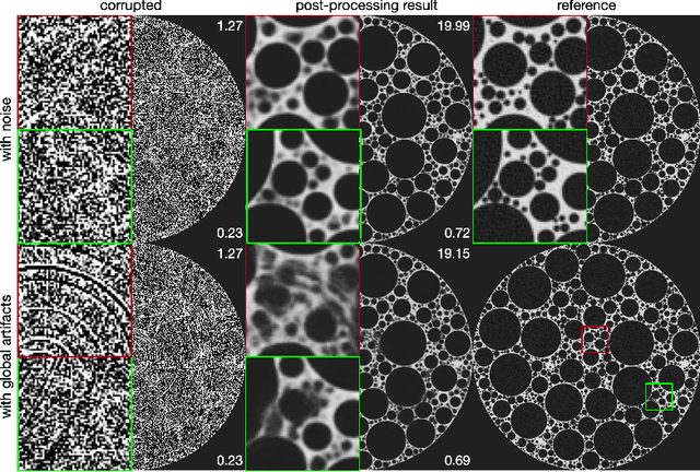 Figure 3 for Multi-stage Deep Learning Artifact Reduction for Computed Tomography