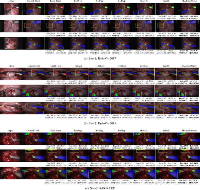 Figure 2 for Personalizing Federated Instrument Segmentation with Visual Trait Priors in Robotic Surgery