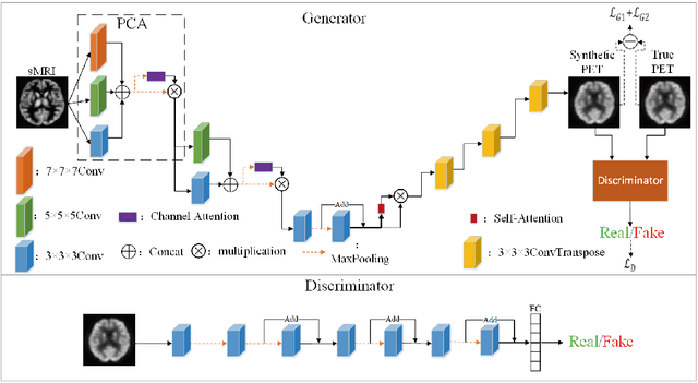 Figure 1 for Cross-modal Medical Image Generation Based on Pyramid Convolutional Attention Network