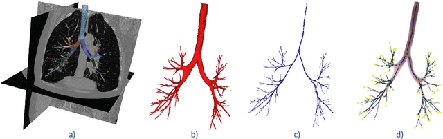 Figure 1 for Multi-site, Multi-domain Airway Tree Modeling : A Public Benchmark for Pulmonary Airway Segmentation