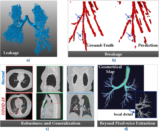 Figure 3 for Multi-site, Multi-domain Airway Tree Modeling : A Public Benchmark for Pulmonary Airway Segmentation