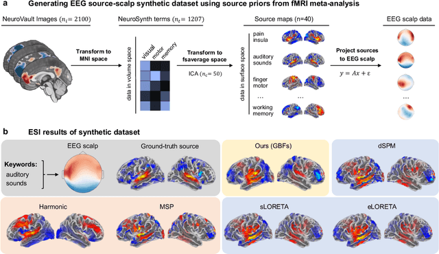 Figure 2 for Advancing EEG/MEG Source Imaging with Geometric-Informed Basis Functions