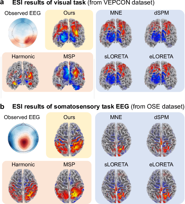 Figure 4 for Advancing EEG/MEG Source Imaging with Geometric-Informed Basis Functions