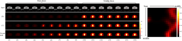 Figure 2 for Diffusion-based Radiotherapy Dose Prediction Guided by Inter-slice Aware Structure Encoding