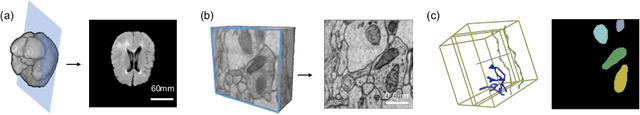 Figure 1 for ShapeMamba-EM: Fine-Tuning Foundation Model with Local Shape Descriptors and Mamba Blocks for 3D EM Image Segmentation