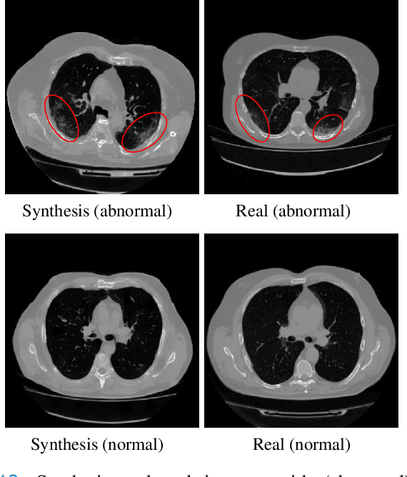 Figure 4 for 3D MedDiffusion: A 3D Medical Diffusion Model for Controllable and High-quality Medical Image Generation