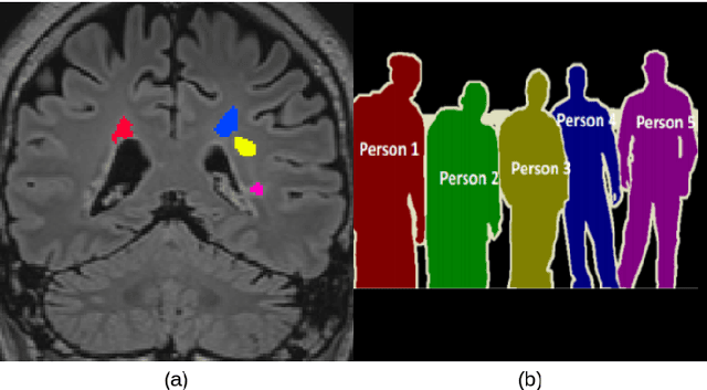 Figure 1 for Instance-level quantitative saliency in multiple sclerosis lesion segmentation