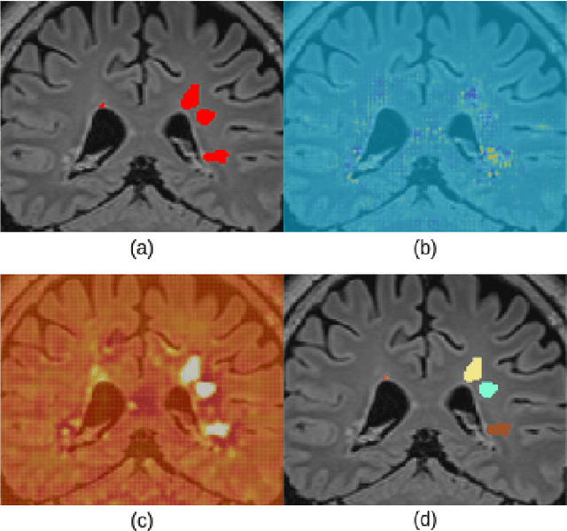 Figure 3 for Instance-level quantitative saliency in multiple sclerosis lesion segmentation