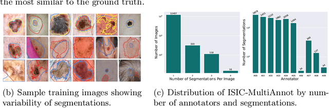 Figure 1 for Segmentation Style Discovery: Application to Skin Lesion Images