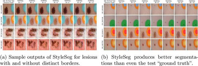 Figure 3 for Segmentation Style Discovery: Application to Skin Lesion Images