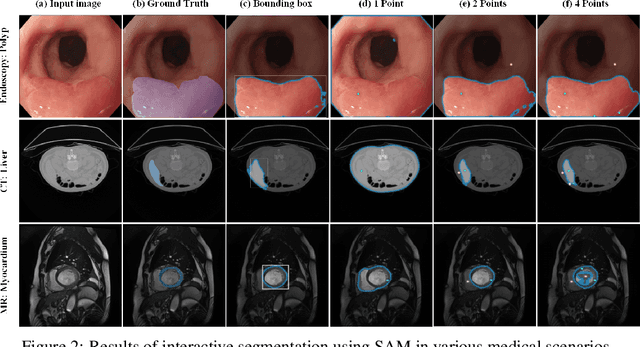 Figure 3 for SAM-Med2D