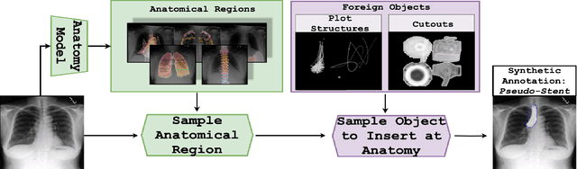 Figure 3 for Foreign object segmentation in chest x-rays through anatomy-guided shape insertion