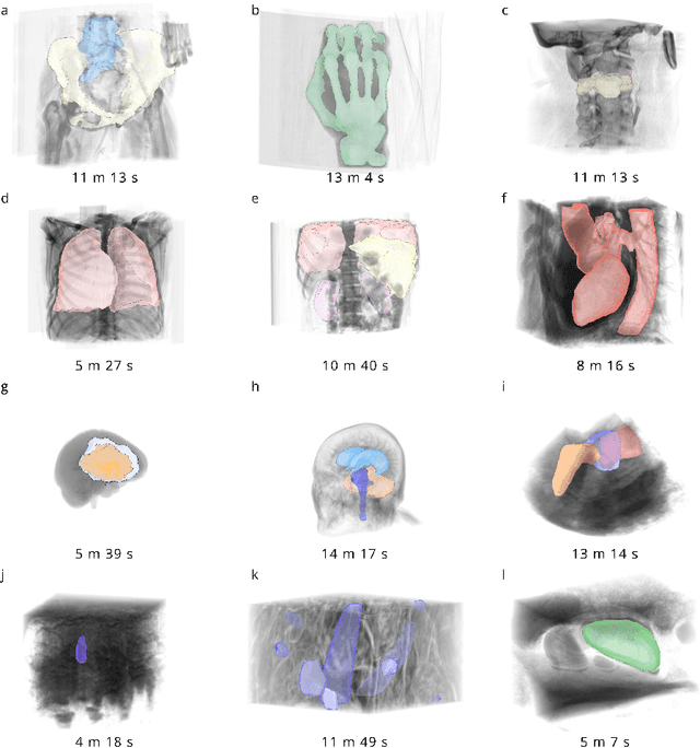 Figure 3 for SAM3D: Zero-Shot Semi-Automatic Segmentation in 3D Medical Images with the Segment Anything Model