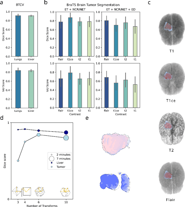 Figure 4 for SAM3D: Zero-Shot Semi-Automatic Segmentation in 3D Medical Images with the Segment Anything Model