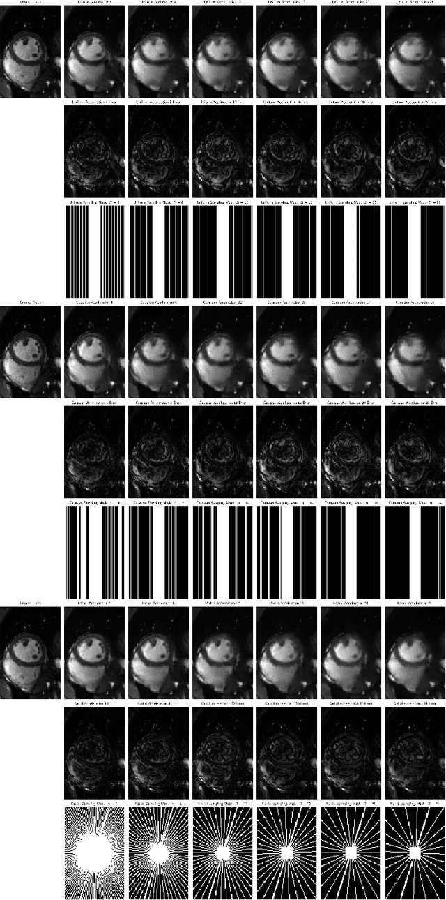 Figure 3 for Low-Rank Conjugate Gradient-Net for Accelerated Cardiac MR Imaging