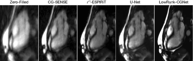 Figure 4 for Low-Rank Conjugate Gradient-Net for Accelerated Cardiac MR Imaging