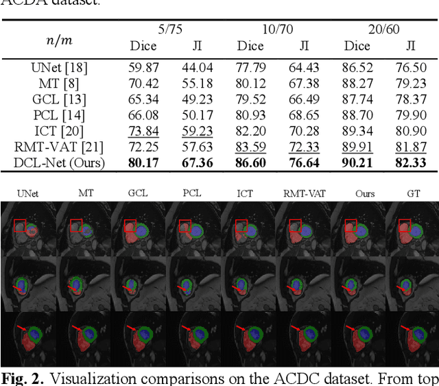 Figure 2 for Dcl-Net: Dual Contrastive Learning Network for Semi-Supervised Multi-Organ Segmentation