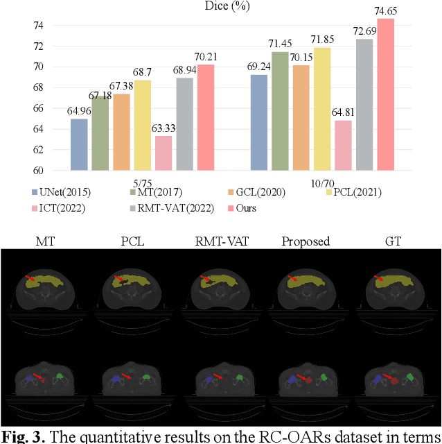 Figure 4 for Dcl-Net: Dual Contrastive Learning Network for Semi-Supervised Multi-Organ Segmentation