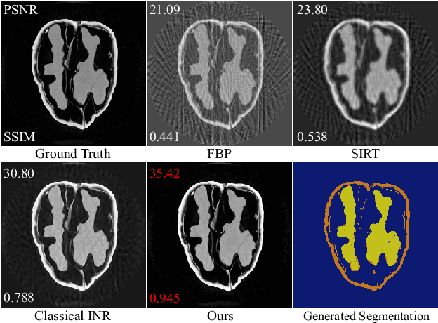 Figure 1 for AC-IND: Sparse CT reconstruction based on attenuation coefficient estimation and implicit neural distribution