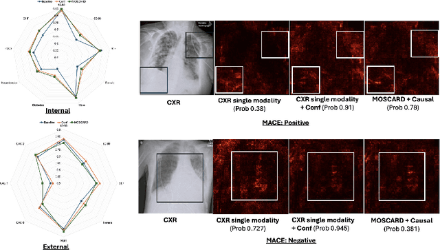 Figure 4 for MOSCARD -- Causal Reasoning and De-confounding for Multimodal Opportunistic Screening of Cardiovascular Adverse Events