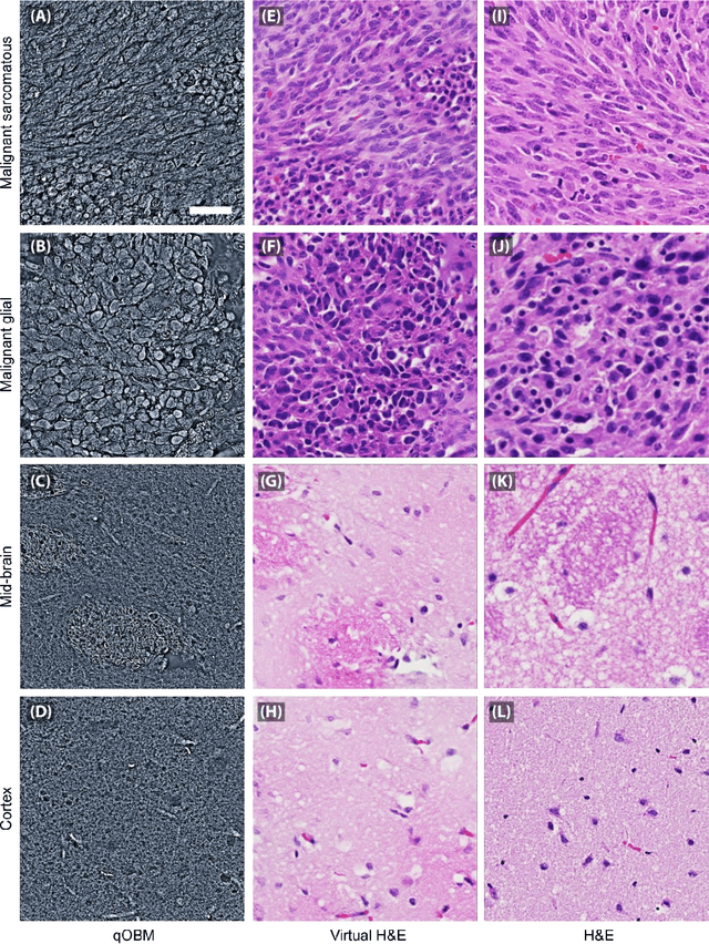 Figure 4 for Label- and slide-free tissue histology using 3D epi-mode quantitative phase imaging and virtual H&E staining