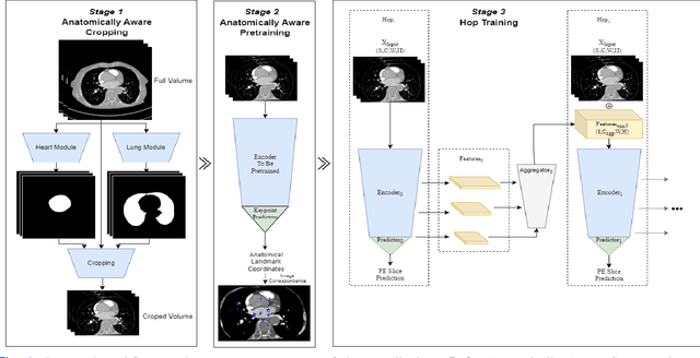 Figure 1 for Anatomically aware dual-hop learning for pulmonary embolism detection in CT pulmonary angiograms