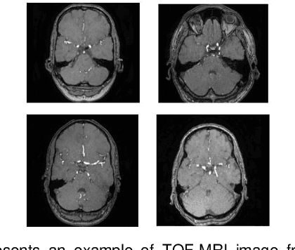 Figure 2 for Automating Vessel Segmentation in the Heart and Brain: A Trend to Develop Multi-Modality and Label-Efficient Deep Learning Techniques