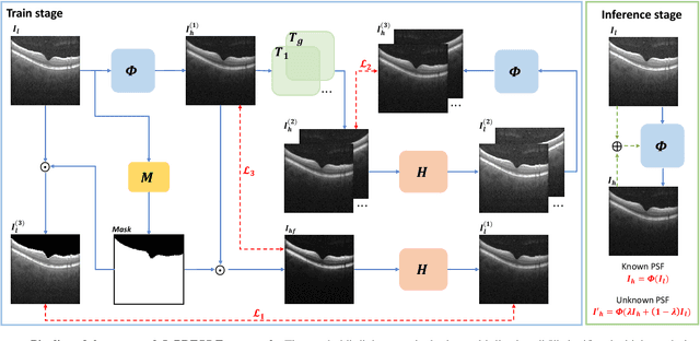 Figure 3 for O-PRESS: Boosting OCT axial resolution with Prior guidance, Recurrence, and Equivariant Self-Supervision