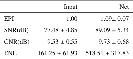 Figure 4 for O-PRESS: Boosting OCT axial resolution with Prior guidance, Recurrence, and Equivariant Self-Supervision