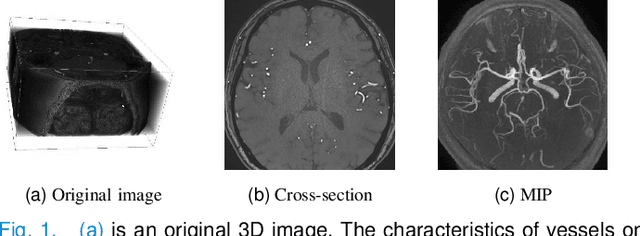 Figure 1 for 3D Vascular Segmentation Supervised by 2D Annotation of Maximum Intensity Projection