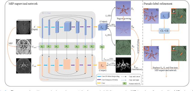 Figure 3 for 3D Vascular Segmentation Supervised by 2D Annotation of Maximum Intensity Projection