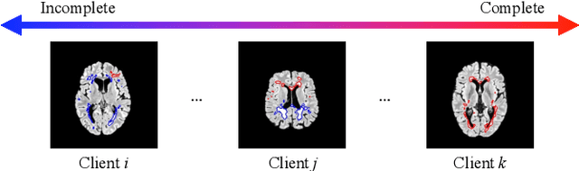 Figure 1 for FedIA: Federated Medical Image Segmentation with Heterogeneous Annotation Completeness