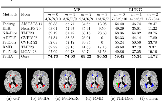 Figure 2 for FedIA: Federated Medical Image Segmentation with Heterogeneous Annotation Completeness