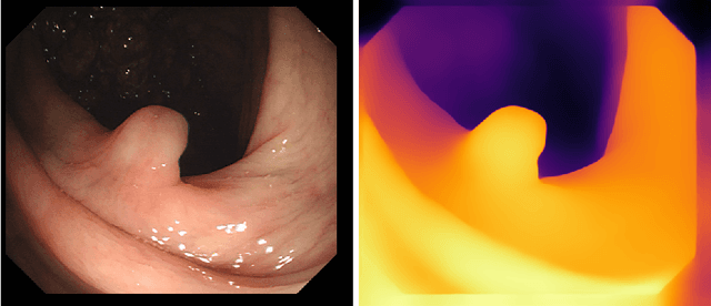 Figure 1 for Polyp-DAM: Polyp segmentation via depth anything model