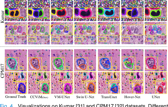 Figure 4 for Merging Context Clustering with Visual State Space Models for Medical Image Segmentation