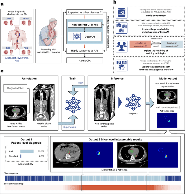 Figure 1 for Rapid and Accurate Diagnosis of Acute Aortic Syndrome using Non-contrast CT: A Large-scale, Retrospective, Multi-center and AI-based Study