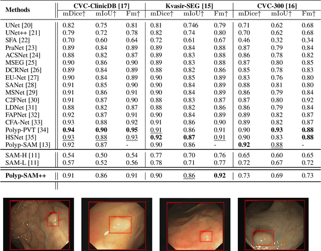 Figure 2 for Polyp-SAM++: Can A Text Guided SAM Perform Better for Polyp Segmentation?