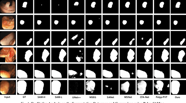 Figure 4 for Polyp-SAM++: Can A Text Guided SAM Perform Better for Polyp Segmentation?