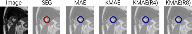 Figure 4 for Classification, Regression and Segmentation directly from k-Space in Cardiac MRI