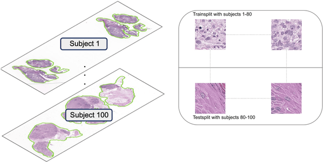 Figure 4 for Unlocking the Potential of Digital Pathology: Novel Baselines for Compression