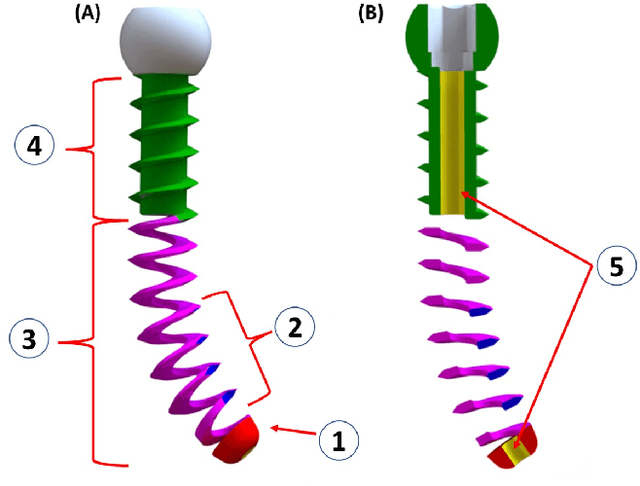 Figure 3 for Towards Biomechanical Evaluation of a Transformative Additively Manufactured Flexible Pedicle Screw for Robotic Spinal Fixation