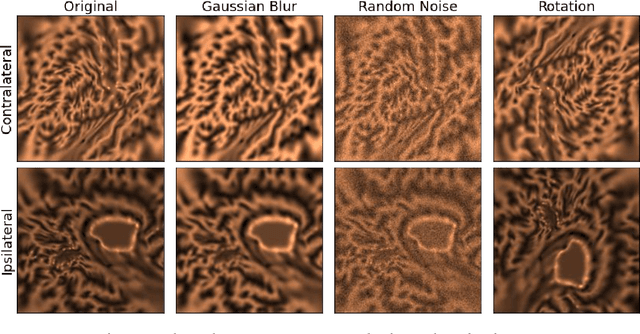 Figure 2 for Identification of morphological fingerprint in perinatal brains using quasi-conformal mapping and contrastive learning