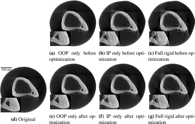 Figure 2 for Motion Compensation via Epipolar Consistency for In-Vivo X-Ray Microscopy