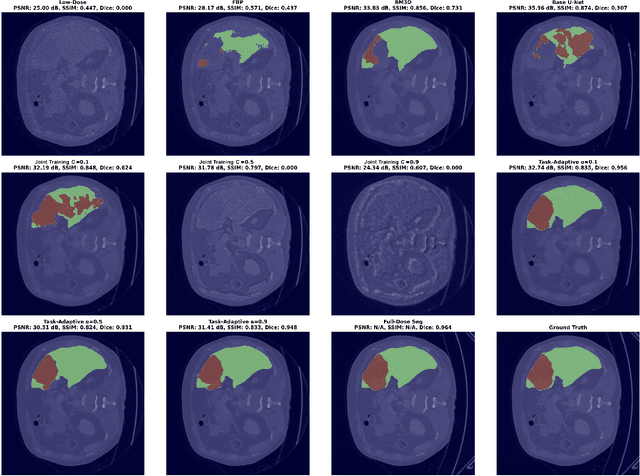Figure 4 for Task-Adaptive Low-Dose CT Reconstruction