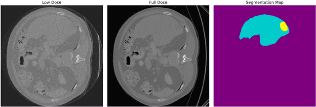 Figure 2 for Task-Adaptive Low-Dose CT Reconstruction