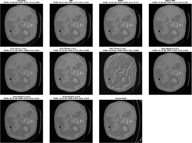 Figure 3 for Task-Adaptive Low-Dose CT Reconstruction